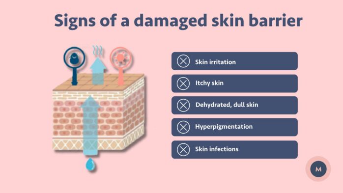 How do you know if your skin barrier is damaged?