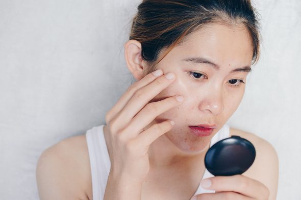 How to get rid of dark circles under eyes fast