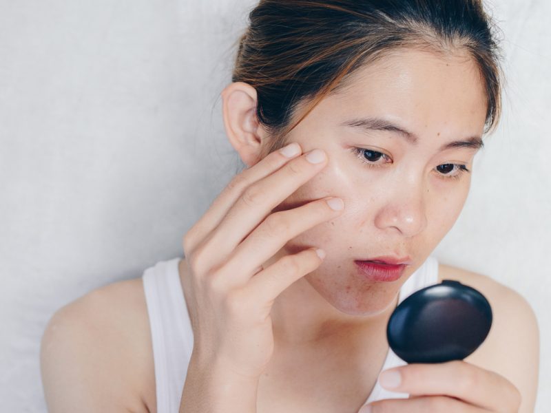 How to get rid of dark circles under eyes fast