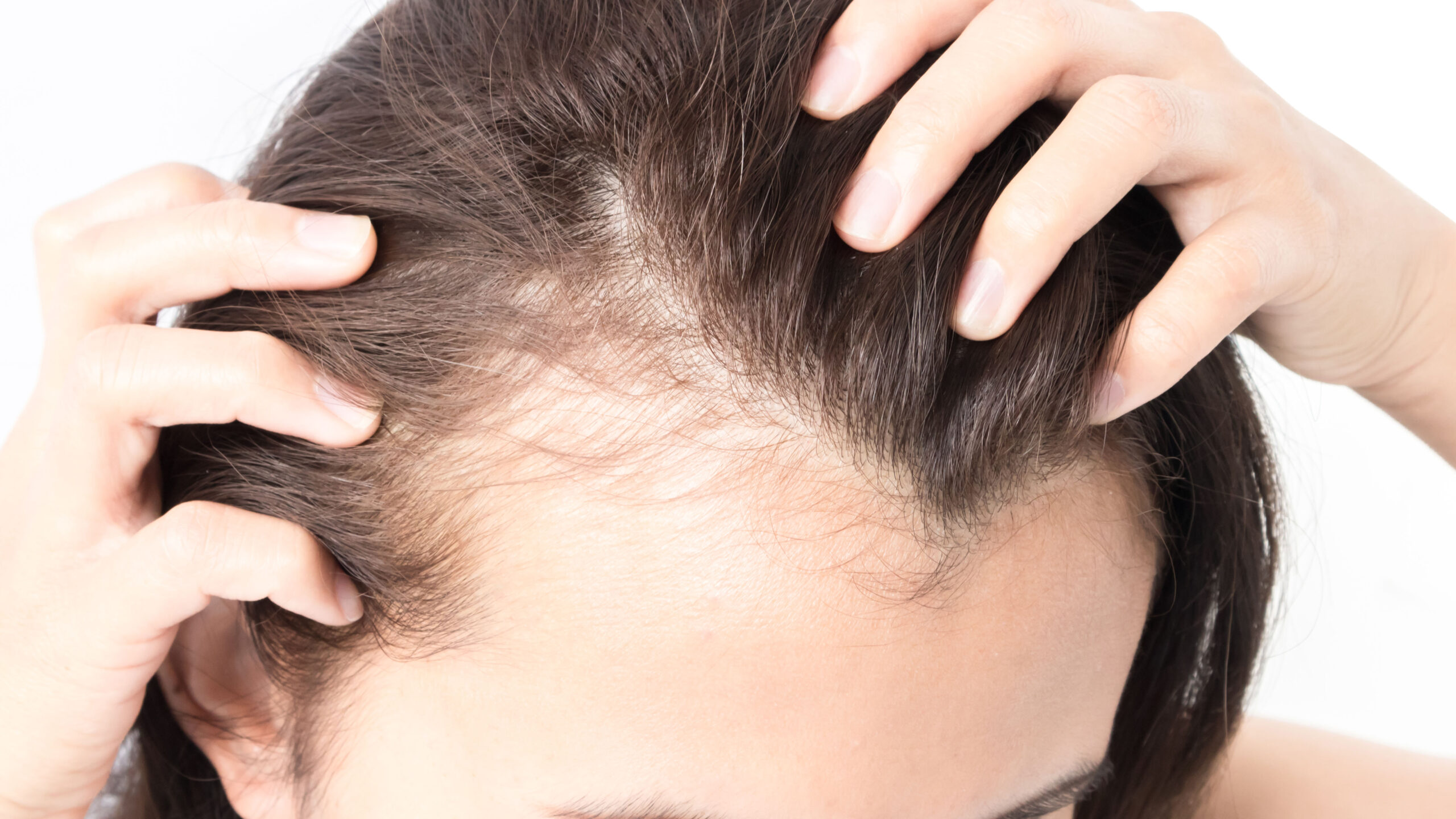 How-to-stop-hair-thinning-and-regrow-thinning-hair-women-female