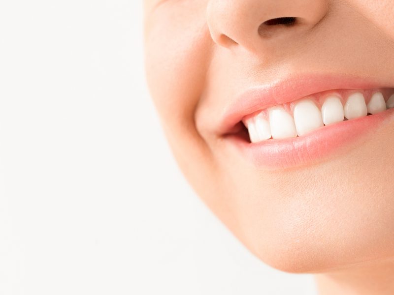 Teeth whitening: How does it work, how much does it cost and is it safe