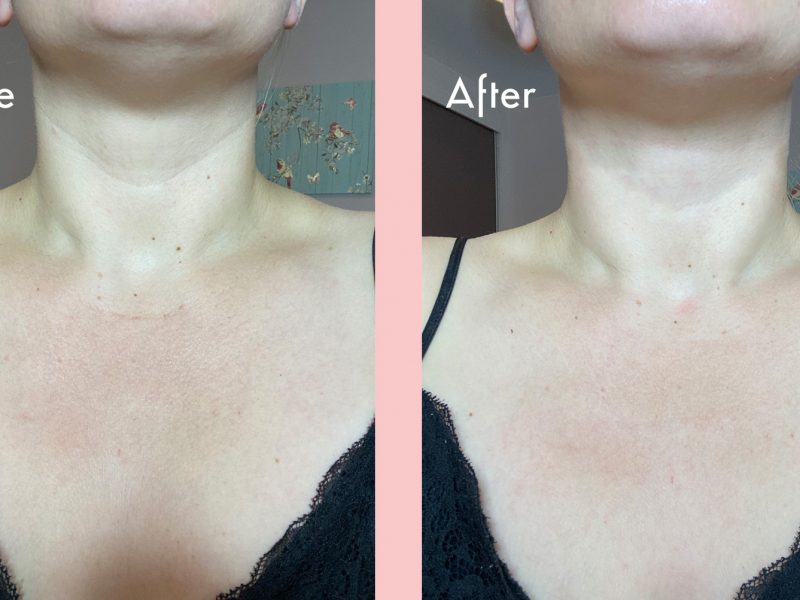 Oia Skin reviews before and after
