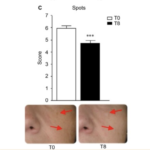 Clinical validation of Aegels